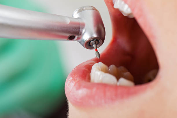 Best Emergency Dentist for Special Needs Patients in Gainesville, VA